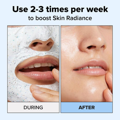 I DEW CARE Wash Off Face Mask - Cake My Day | With Hyaluronic Acid, Self Skin Care, Facial Treatment, Vegan, Cruelty-Free, Paraben-Free, Exfoliating, Deep Cleansing Detox, Stocking Stuffers, 3.38 Oz