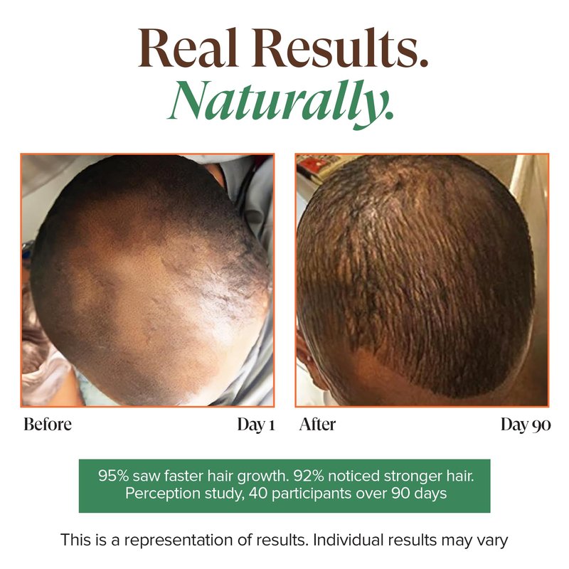 Kreyol Essence - Haitian Black Castor Oil for Skin and Hair, Glass Bottle - Fuller-Looking Hair, Pure, Hexane Free, Cold Pressed, Natural Humectant (Original, 3.4 fl oz)