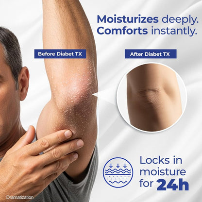 Goicoechea Diabet TX Diabetic Lotion with Urea for Dry Skin | Soothing Hydrating Cream with Aloe, Oatmeal & Vitamin E for Hands, Elbows, Feet & Body | Extra Dry Skin Support, 13.5 Oz | 3-Pack