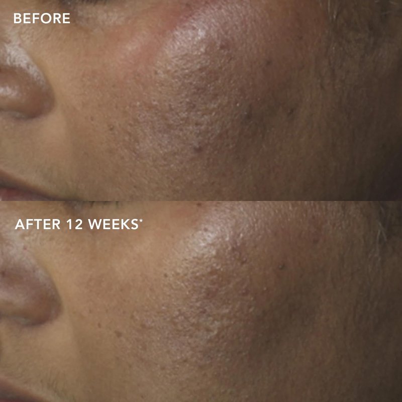 IMAGE Skincare, IMAGE MD Restoring Power-C Serum, 20% Vitamin C, Ferulic Acid Facial Serum to Reduce Pigmentation, Firm, Brighten Skin, 1 fl oz