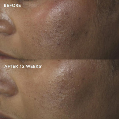 IMAGE Skincare, IMAGE MD Restoring Power-C Serum, 20% Vitamin C, Ferulic Acid Facial Serum to Reduce Pigmentation, Firm, Brighten Skin, 1 fl oz